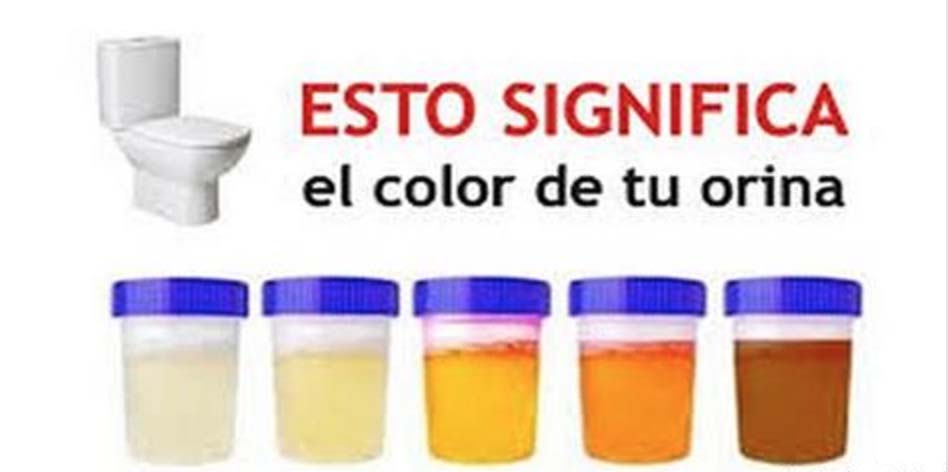 EL COLOR DE LA ORINA DICE TODO SOBRE TU SALUD ¡ESTO ES LO QUE SIGNIFICA ...